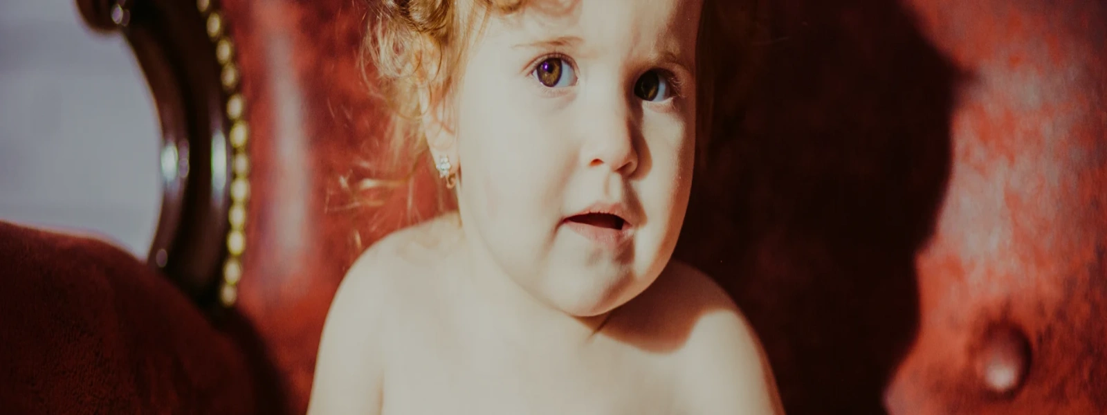 Bebeklerde Kontakt Dermatit Nedenleri ve Tedavisi