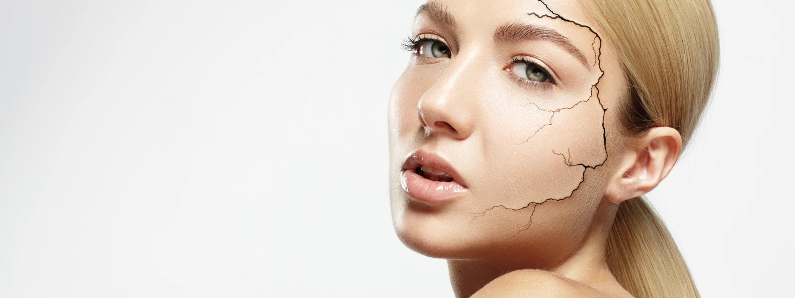 Cilt Çatlağı Neden Olur? Cilt Çatlağı Nasıl Geçer?