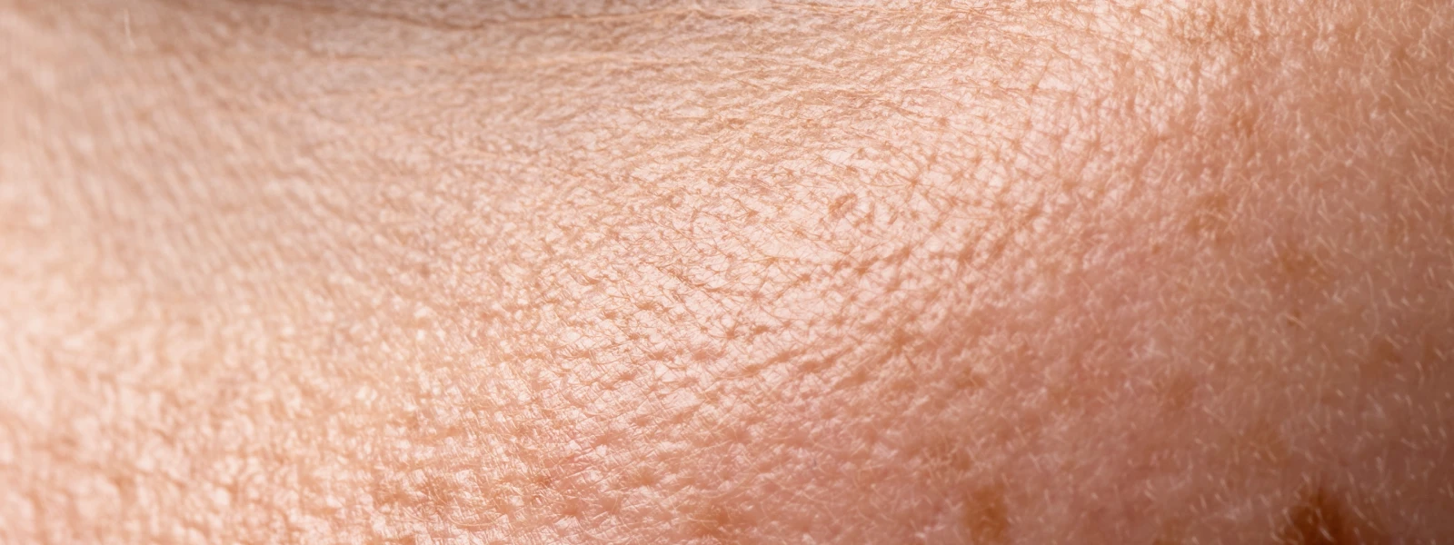 Gözenek Nedir? Ciltte Gözenek Sıkılaştırma Yöntemleri