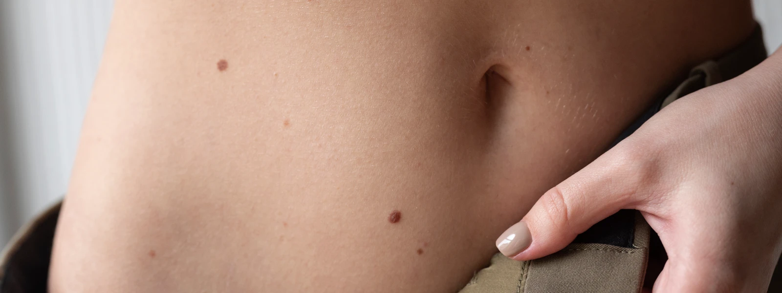 Ciltte Kahverengi Lekeler Neden Olur?