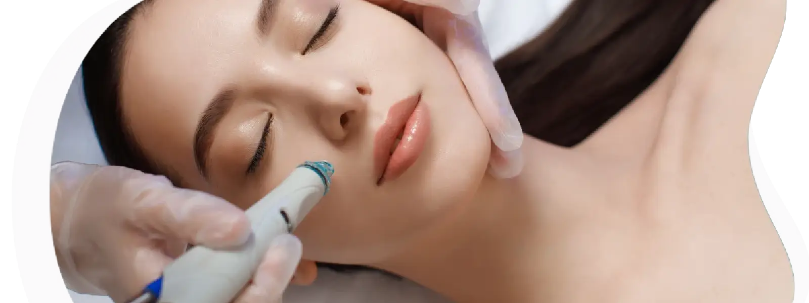 Hydrafacial Cilt Bakımı Nedir? Nasıl Uygulanır?