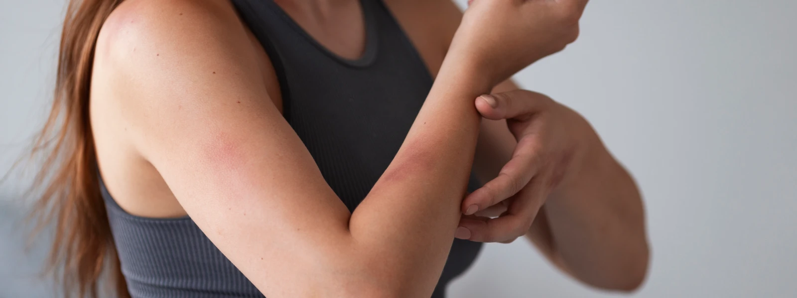 Cilt Tahrişi Neden Olur? Tahriş Olan Cilde Ne İyi Gelir?