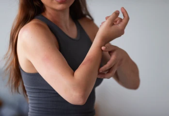 Tahriş Olan Cilde Ne İyi Gelir?