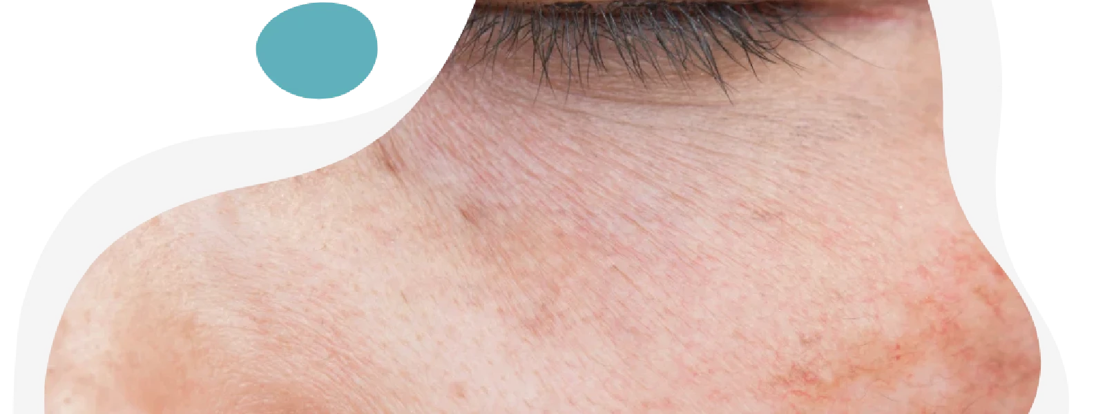 Yıpranmış Cilt Nasıl Düzelir? Bakımı Nasıl Olmalıdır?