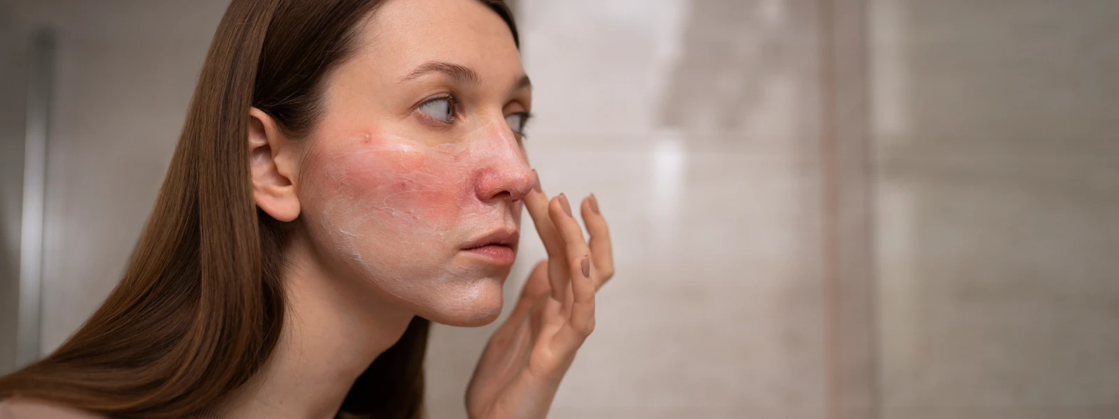 Yüzde Kızarıklık Neden Olur? Yüzde Kızarıklık Nasıl Geçer?