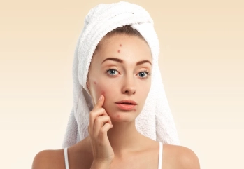 Niacinamide Nedir? Sivilce Yapar Mı?