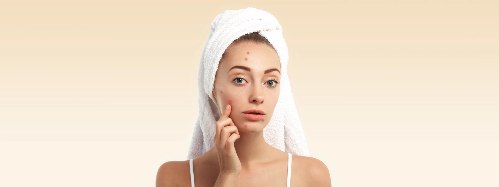 Niacinamide Nedir? Sivilce Yapar Mı?  