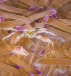 Lactobacillus Nedir? Lactobacillus Faydaları