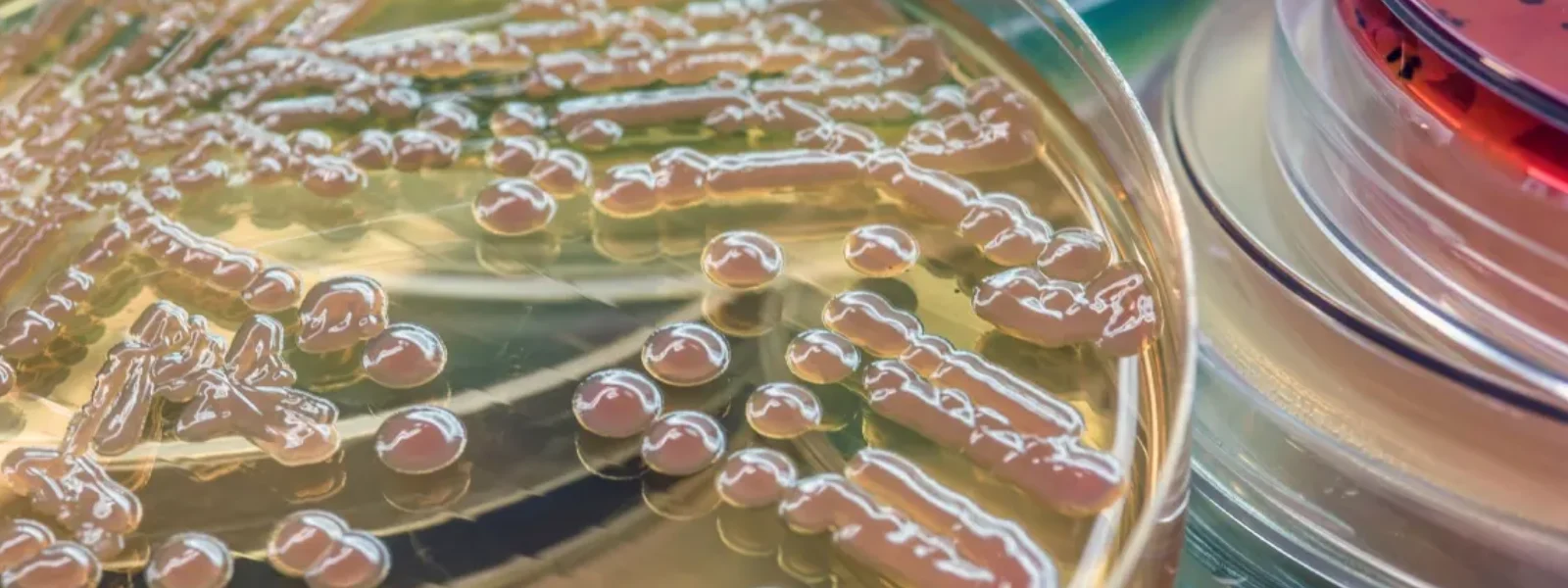 Bifidobacterium Bifidum Nedir? Bifido Bakterisi Faydaları Nelerdir?