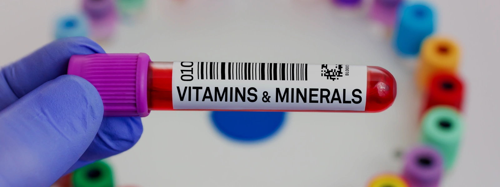 a vitamini nedir