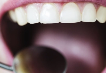 Diş Eti Çekilmesi Hangi Vitamin Eksikliğinden Olur