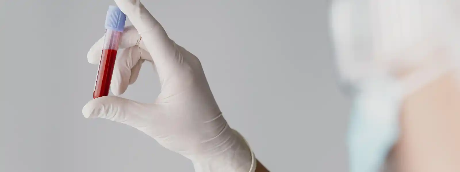 K Vitamini Nedir? K Vitamini Ne işe Yarar?