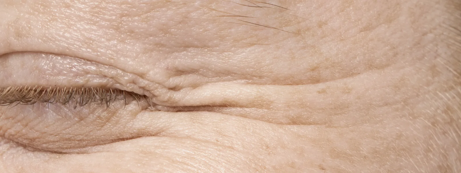 niacinamide serum ne işe yarar